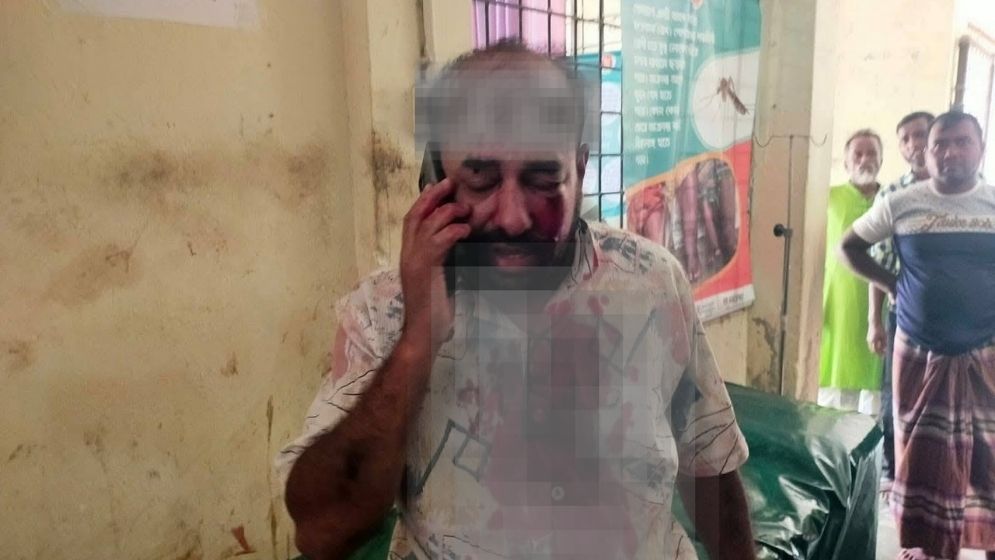 Jamaat men attacks on journalist in Kushtia