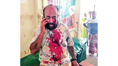 Journalist allegedly assaulted by Jamaat activists in Kushtia