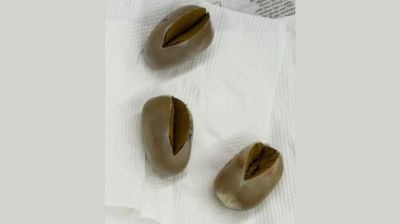 3 gold pieces worth Tk1.74cr recovered from passenger’s rectum at Dhaka airport