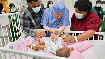 Fijian conjoined twins separated successfully at Riyadh hospital