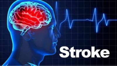 Healthy lifestyle can prevent 90% strokes: Specialists